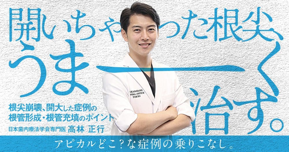 開いちゃった根尖、うまーく治す。