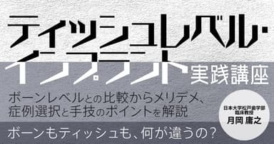 ティッシュレベル・インプラント実践講座