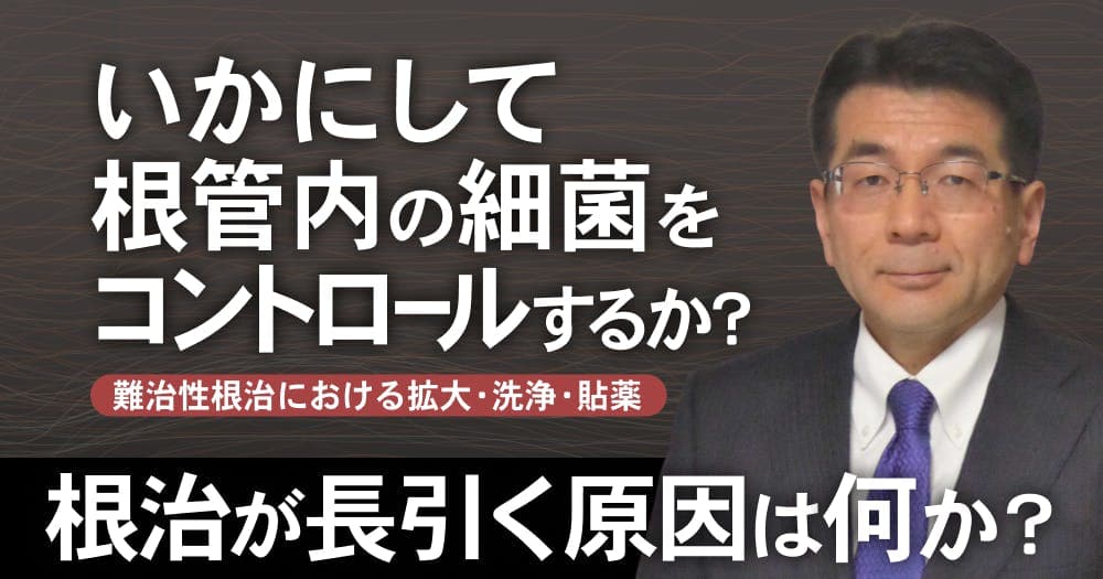 【再放送】いかにして根管内の細菌をコントロールするか？ - 難治性根管治療における拡大・洗浄・貼薬