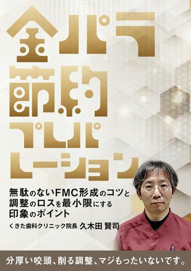 ランキング10位の金パラ節約プレパレーション