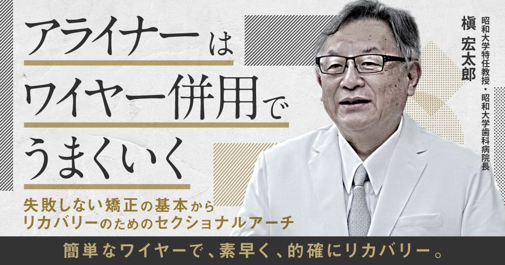 アライナーはワイヤー併用でうまくいく - 失敗しない矯正の基本からリカバリーのためのセクショナルアーチ