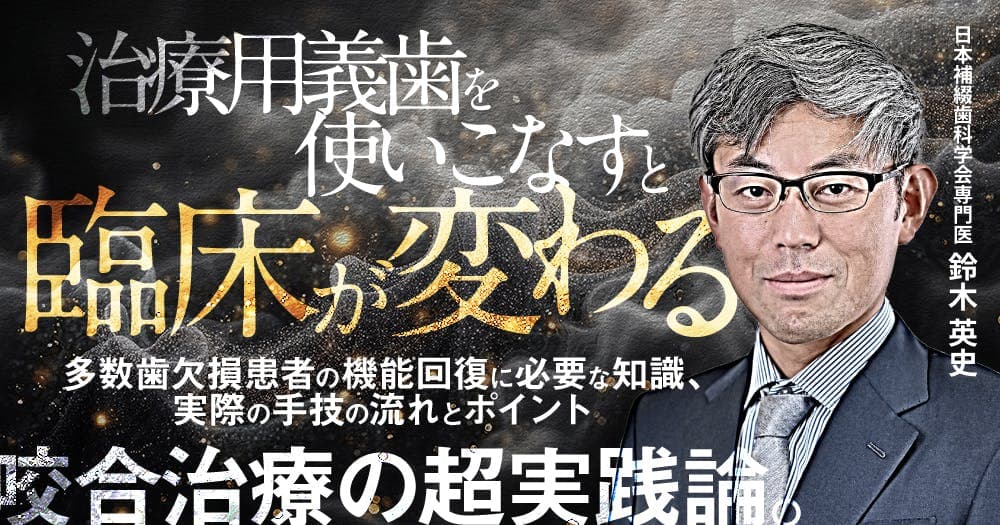 治療用義歯を使いこなすと臨床が変わる - 多数歯欠損患者の機能回復に必要な知識、実際の手技の流れとポイント