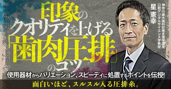 印象のクオリティを上げる「歯肉圧排」のコツ