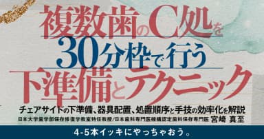 複数歯のC処を30分枠で行う下準備とテクニック