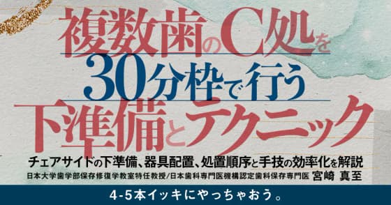 複数歯のC処を30分枠で行う下準備とテクニック