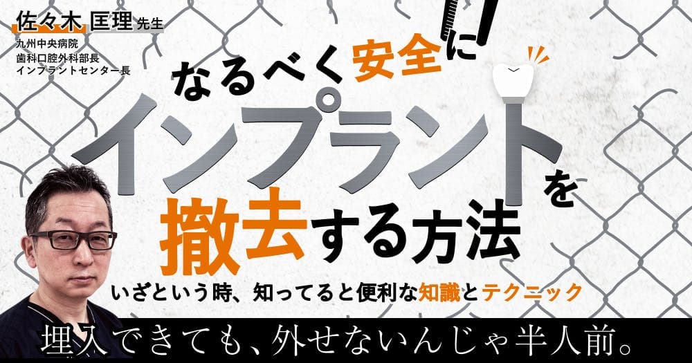 なるべく安全にインプラントを撤去する方法。インプラント周囲炎に罹る前に。