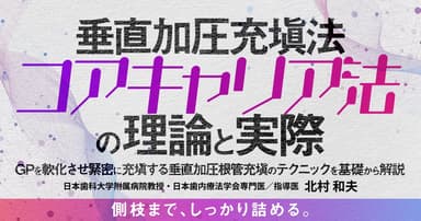 垂直加圧充塡法「コアキャリア法」の理論と実際