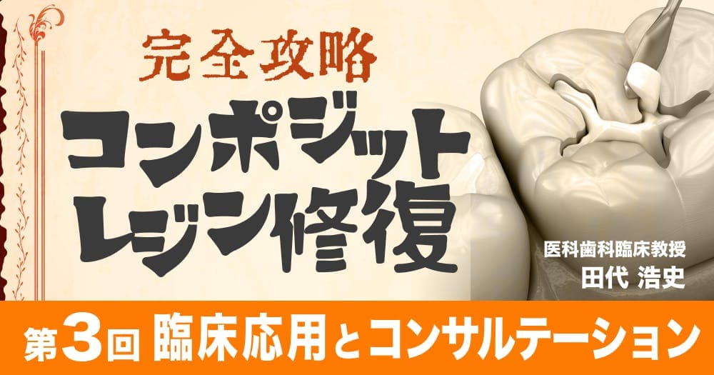 【完全攻略】コンポジットレジン修復