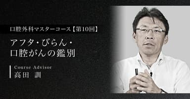 【第10回】アフタ・びらん・口腔がんの鑑別