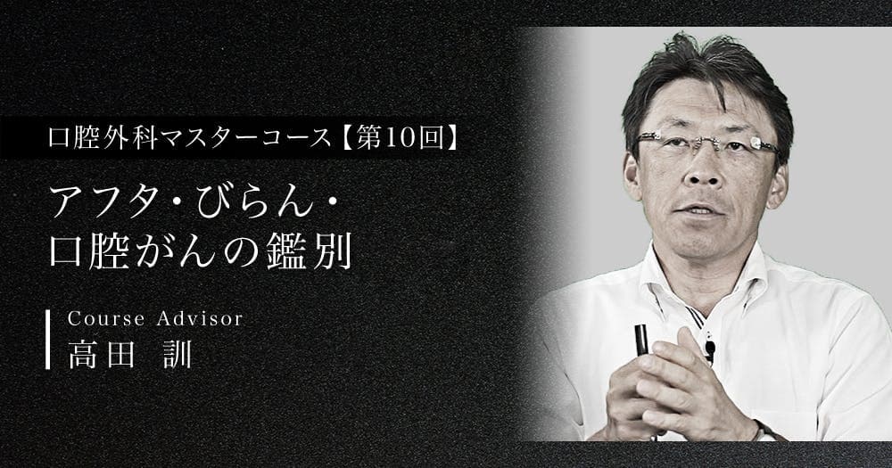 【第10回】アフタ・びらん・口腔がんの鑑別