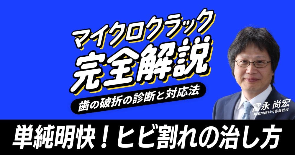 マイクロクラック完全解説 - 歯の破折の診断と対応法