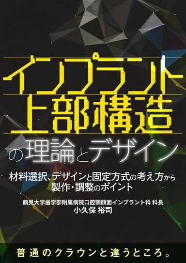 ランキング6位のインプラント上部構造の理論とデザイン
