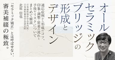 オールセラミックブリッジの形成とデザイン