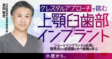 「クレスタルアプローチ」で挑む上顎臼歯部インプラント