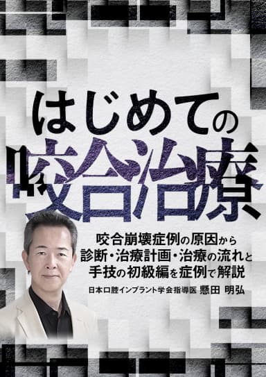 ランキング10位のはじめての「咬合治療」