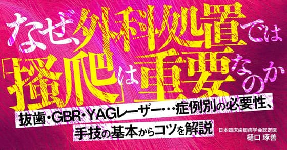 なぜ、外科処置では「搔爬」が重要なのか？