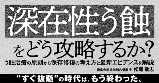 「深在性う蝕」をどう攻略するか？
