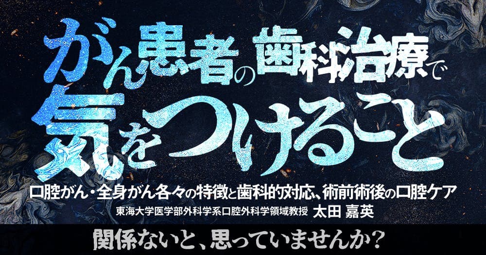 がん患者の歯科治療で気をつけること - 口腔がん・全身がん各々の特徴と歯科的対応、術前術後の口腔ケア