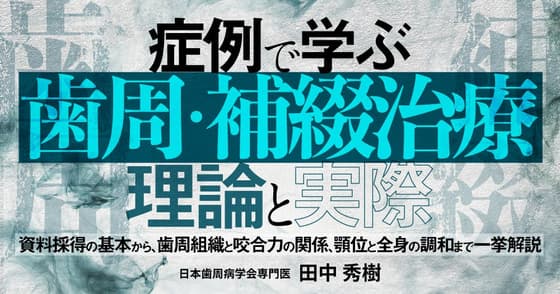 症例で学ぶ「歯周・補綴治療」の理論と実際