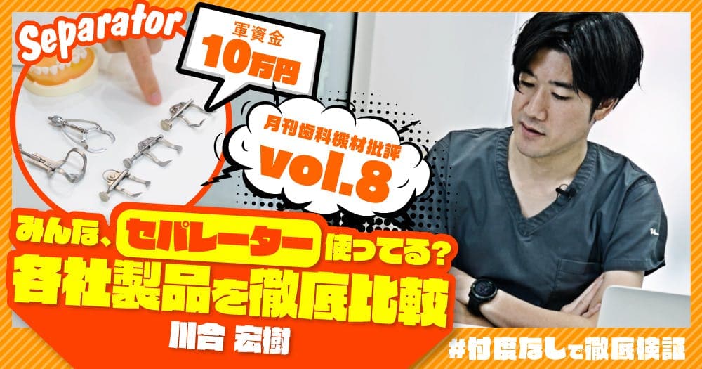 みんな、セパレーター使ってる？各社製品を徹底比較