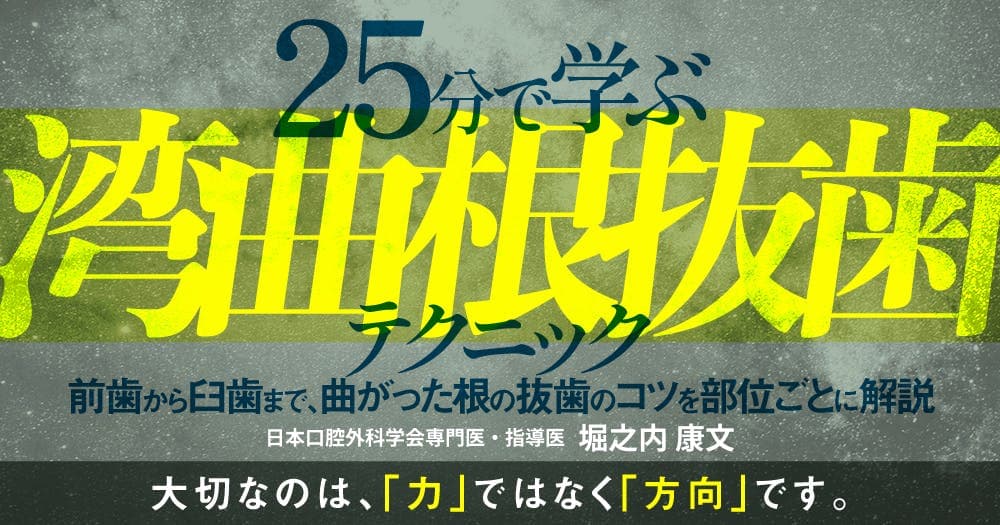 25分で学ぶ「湾曲根抜歯」テクニック