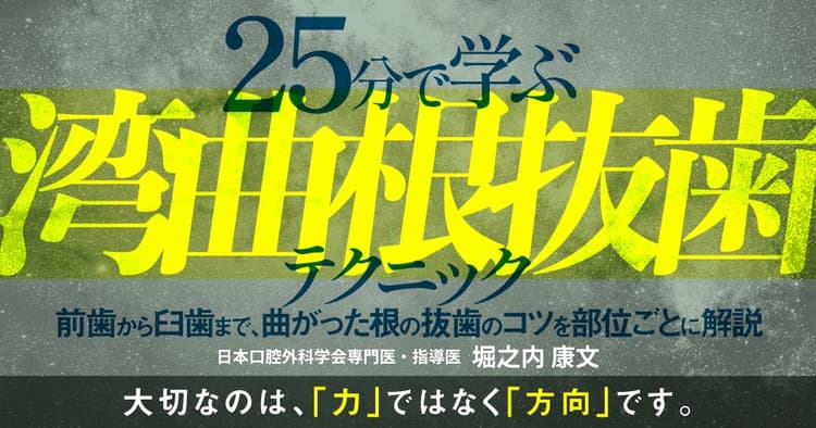 25分で学ぶ「湾曲根抜歯」テクニック