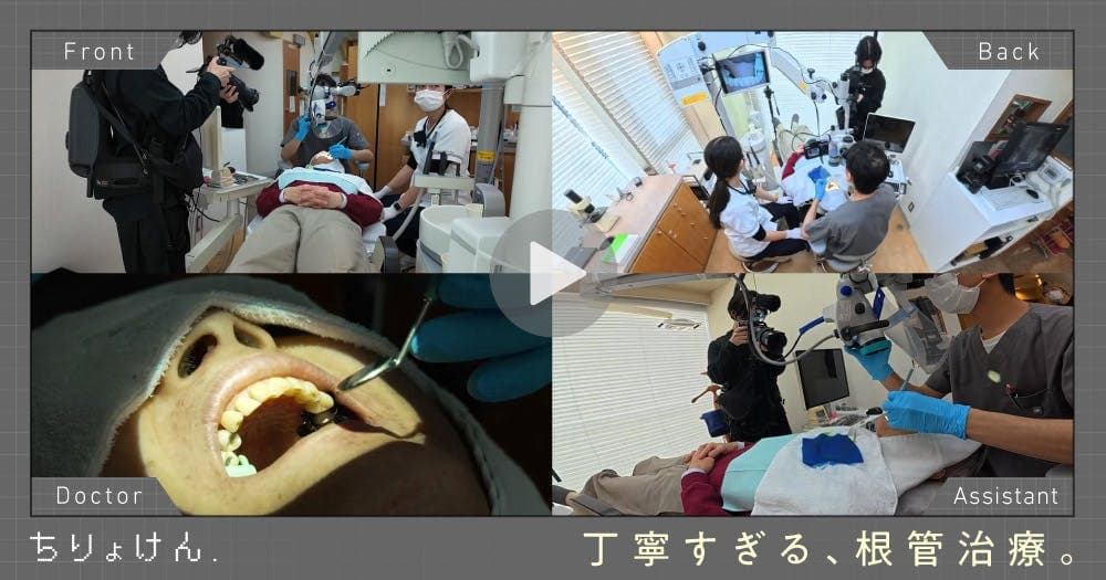 【治療見学】自費の根管治療（上顎左側第二小臼歯） - ラバーダム装着から根管洗浄、レーザー応用、マイクロ下での根管治療の流れ