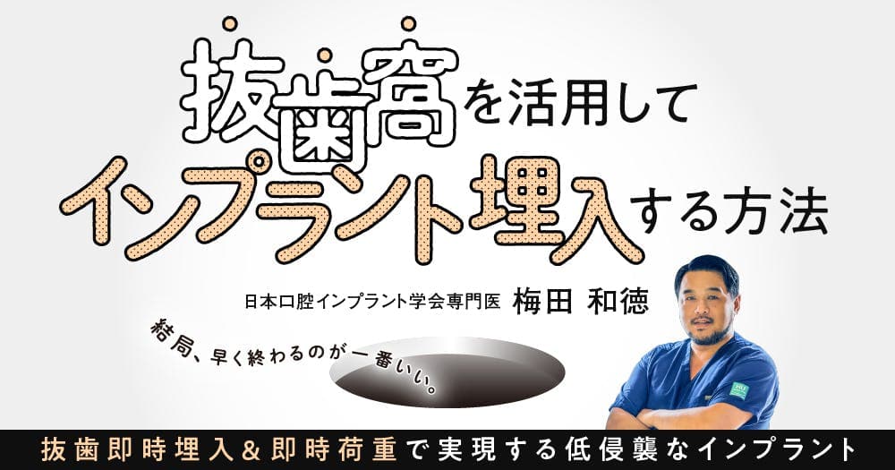抜歯窩を活用してインプラント埋入する方法 - 抜歯即時埋入＆即時荷重で実現する低侵襲なインプラント