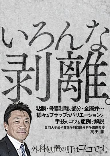 ランキング3位のいろんな剥離。