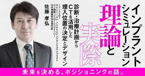 インプラントシミュレーションの理論と実際