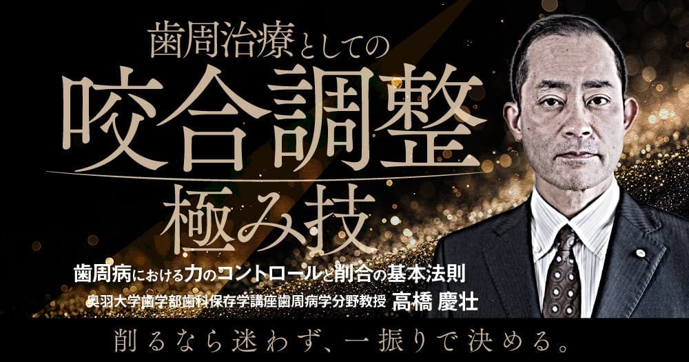 歯周治療としての「咬合調整」極み技 - 歯周病における力のコントロールと削合の基本法則