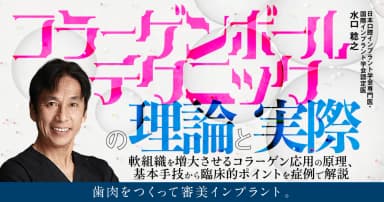 コラーゲンボールテクニックの理論と実際