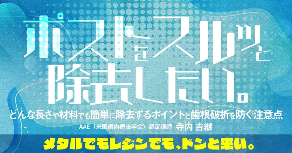 ポストをスルッと除去したい。 - どんな長さや材料でも簡単に除去するポイントと歯根破折を防ぐ注意点