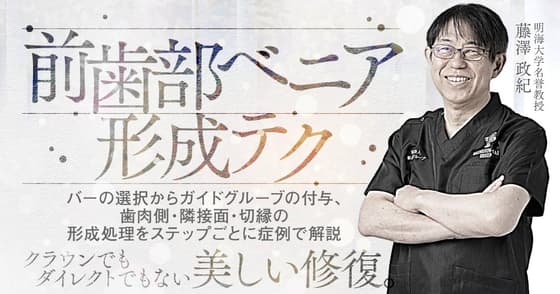 前歯部ベニア形成テク