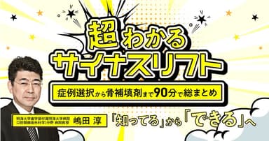 超わかる「サイナスリフト」