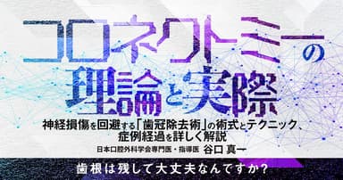 コロネクトミーの理論と実際
