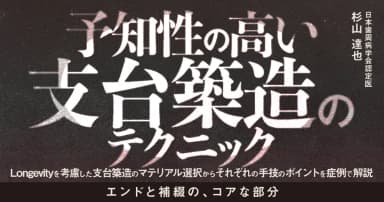 予知性の高い支台築造のテクニック