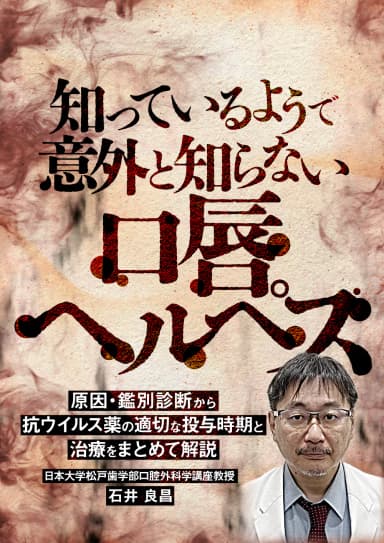 ランキング9位の知っているようで意外と知らない「口唇ヘルペス」