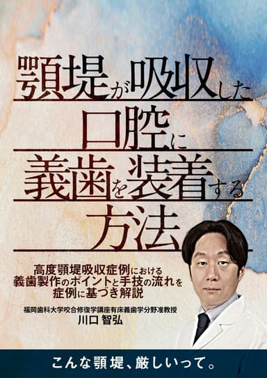 ランキング17位の顎堤が吸収した口腔に義歯を装着する方法