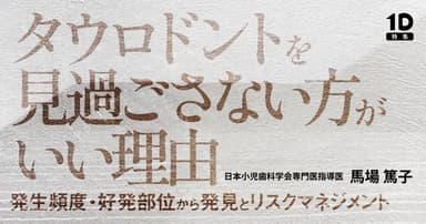 タウロドントを見過ごさない方がいい理由