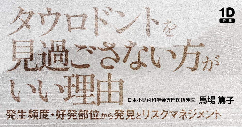 タウロドントを見過ごさない方がいい理由
