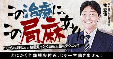 この治療に、この局麻あり。