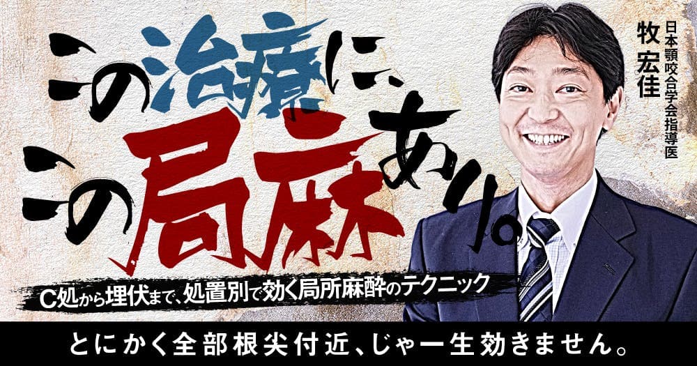 この治療に、この局麻あり。