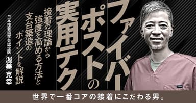 ファイバーポストの実用テク