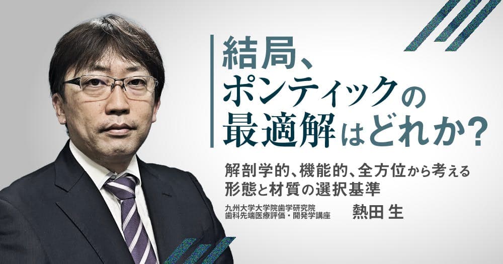 結局、ポンティックの最適解はどれか？ - 解剖学的、機能的、全方位から考える形態と材質の選択基準