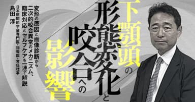 下顎頭の形態変化と咬合への影響