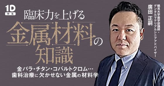 臨床力を上げる「金属材料」の知識