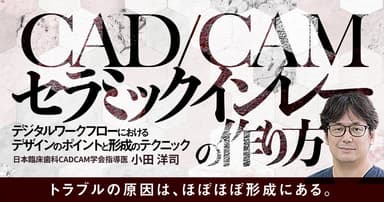 CAD/CAMセラミックインレーの作り方