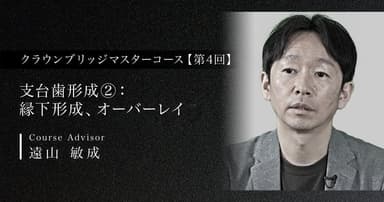 【第4回】支台歯形成②：縁下形成、オーバーレイ