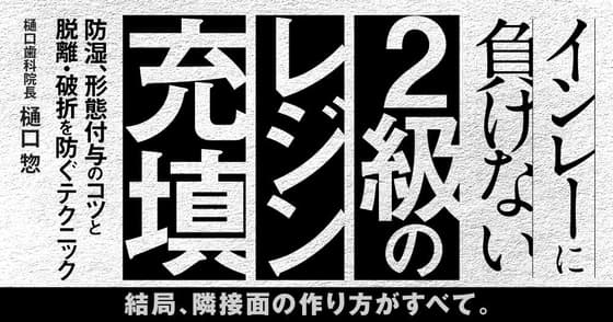 インレーに負けない「2級のレジン充填」